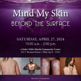 Graphic designs for Beyond the Surface vitiligo event